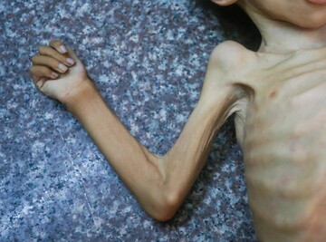 Erasing Gaza via starvation