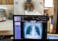 Iran ready to offer COVID-19 diagnostic system free of charge