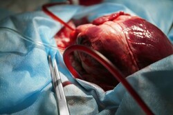Organ donation rises 66% in 6 months