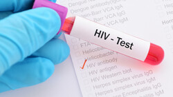 Over 100,000 tests conducted through HIV campaign