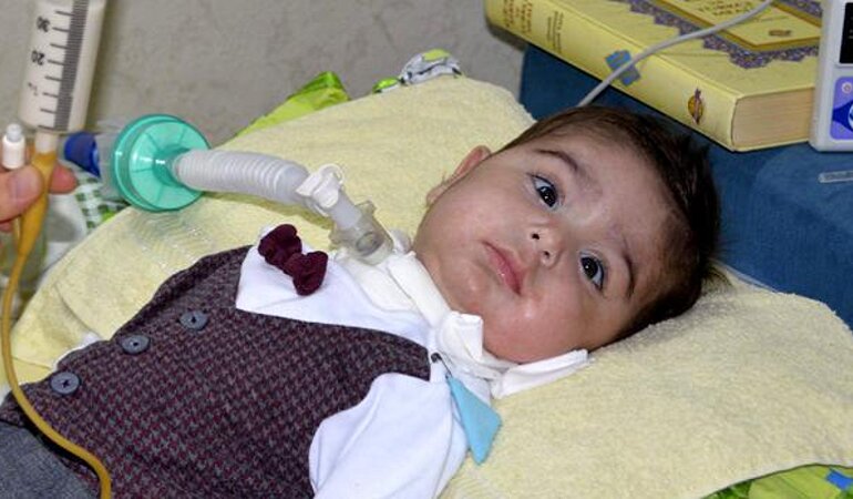 FDA imports medicine for SMA patients