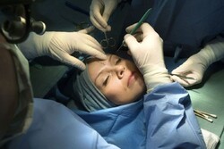 Medical tourists mostly visit Iran for cosmetic surgery