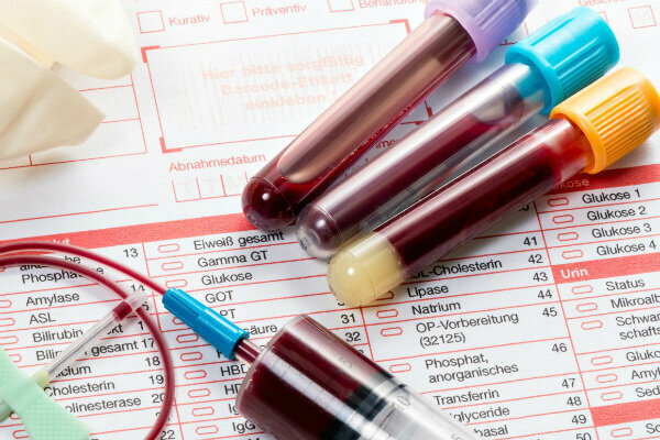 Plan underway to prevent three most common cancers among women