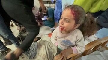 Wounded Palestinian girl