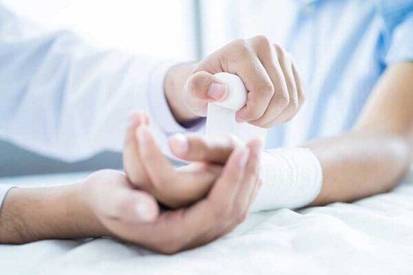 Iran achieves technology to manufacture dressings for EB patients