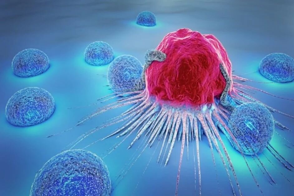 Iranian medicine treats breast, stomach cancers