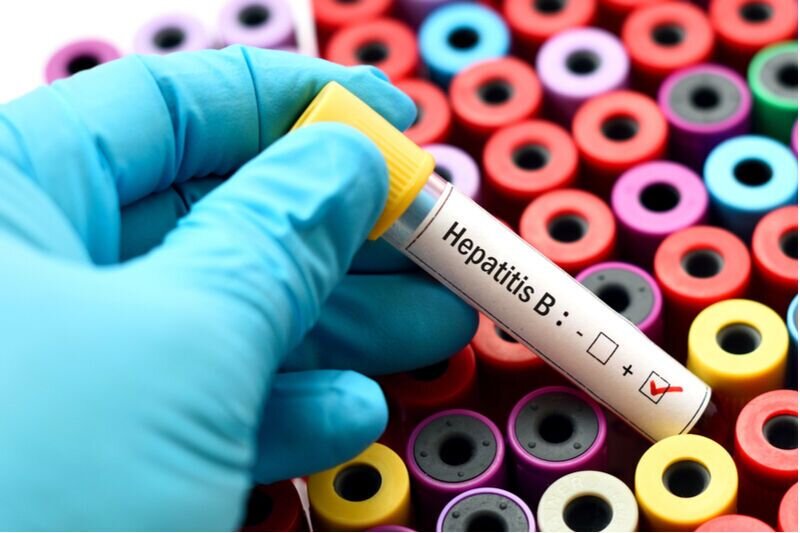 Hepatitis B control program to be implemented