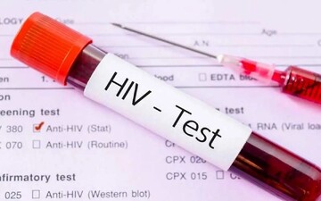 National HIV testing campaign underway