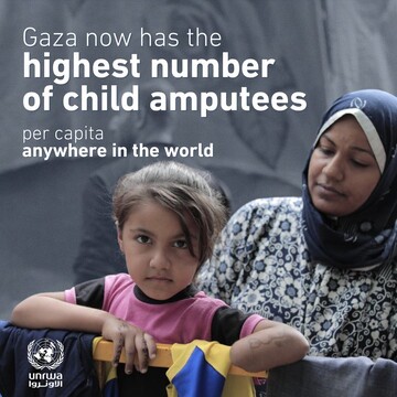 child amputees in Gaza