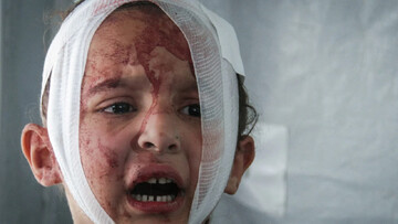 Children and women account for most of the victims in Gaza