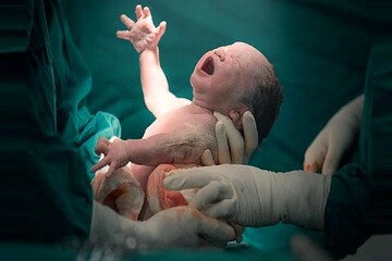 UNFPA lauds Iran’s efforts in reducing maternal mortality