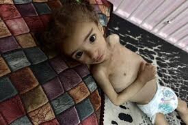 Gaza children could die soon