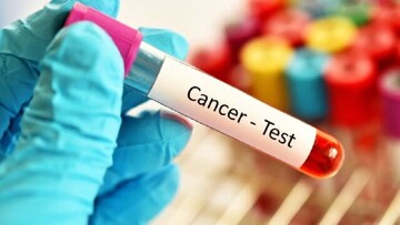 Health ministry to carry out comprehensive cancer screening program