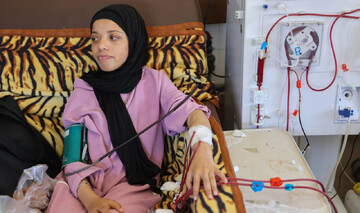 A woman with kidney problem