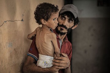 650,000 children in Gaza at risk of death