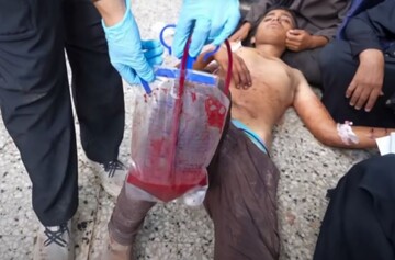 Tehran demands emergency OIC meeting as Gaza faces famine, mass deaths