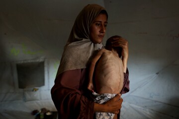Gaza Famine
