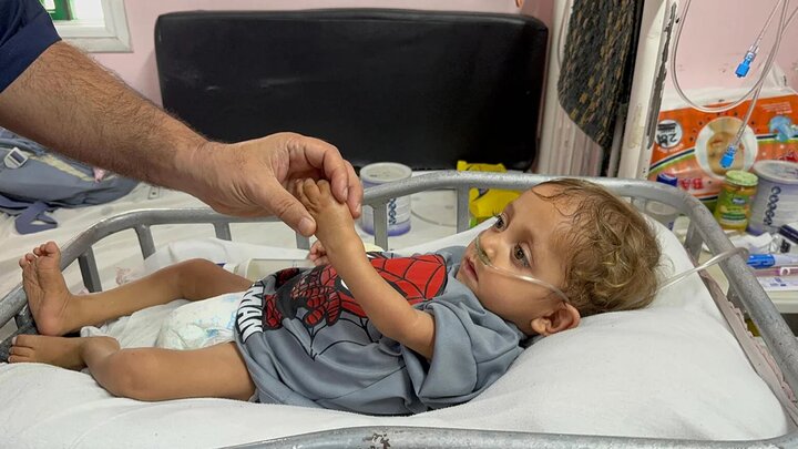 Gaza malnutrition