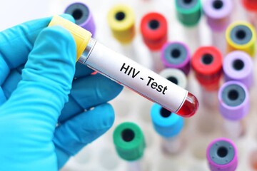 National HIV testing campaign underway