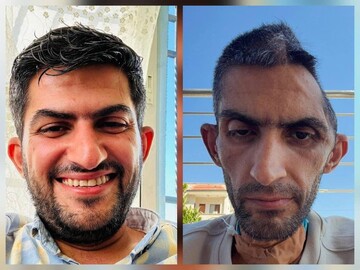 Two photos of Mujahed Bani Mufleh before and after detention by Israel