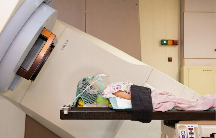 Radiotherapy remains a cornerstone of cancer treatment