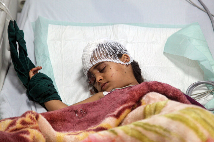 Injured Iranian child in US strike