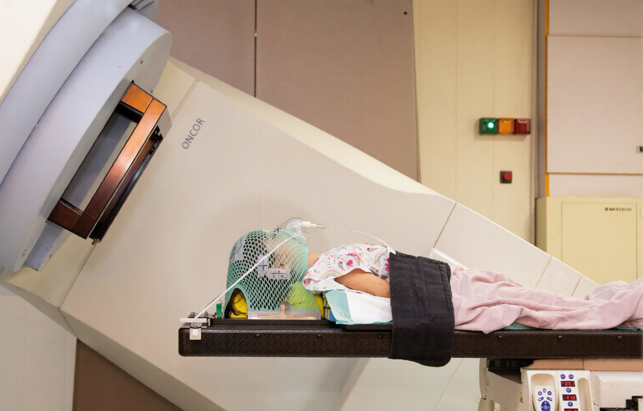 Radiotherapy remains a cornerstone of cancer treatment